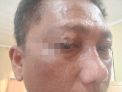 Wartawan PJS DPC Toba Dianiaya, Saat Liput Galian C Diduga Ilegal